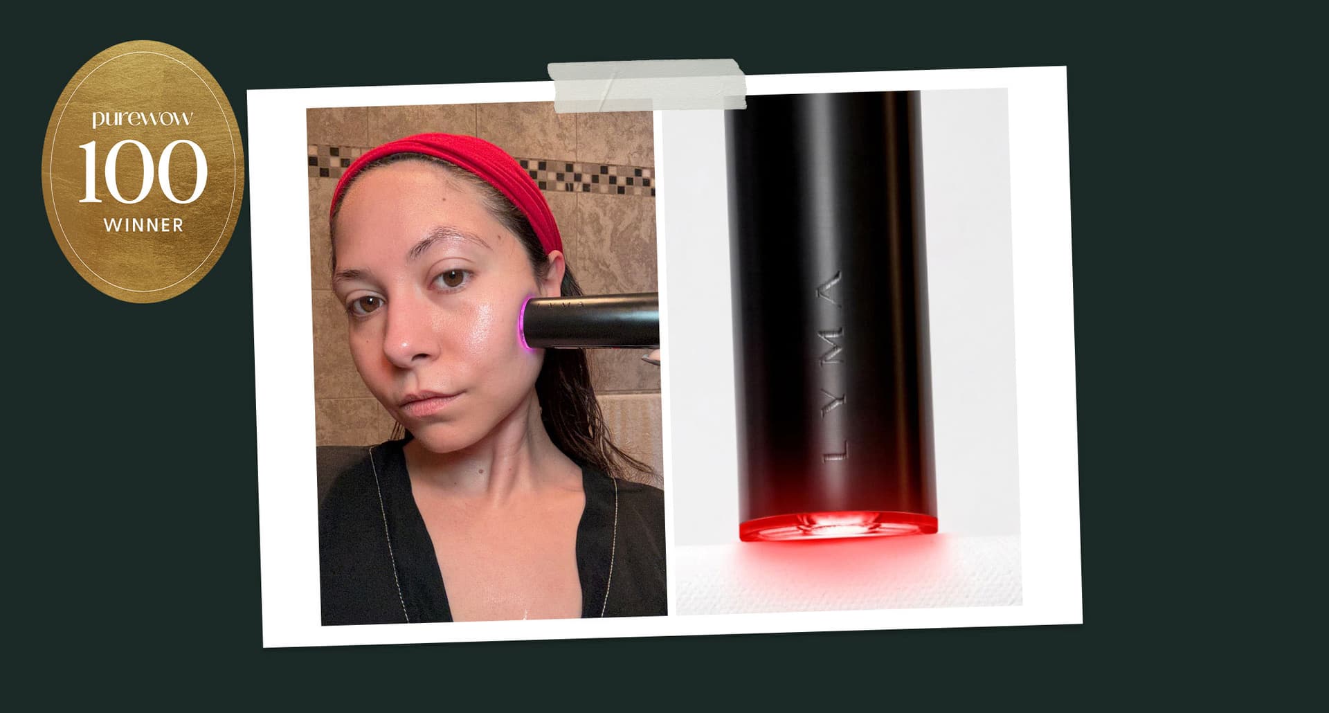 Lyma Laser Review: Original Photo of Stephanie Maida