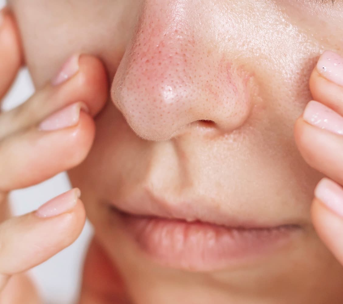 Close up of woman's nose, concerned she has "pregnancy nose"