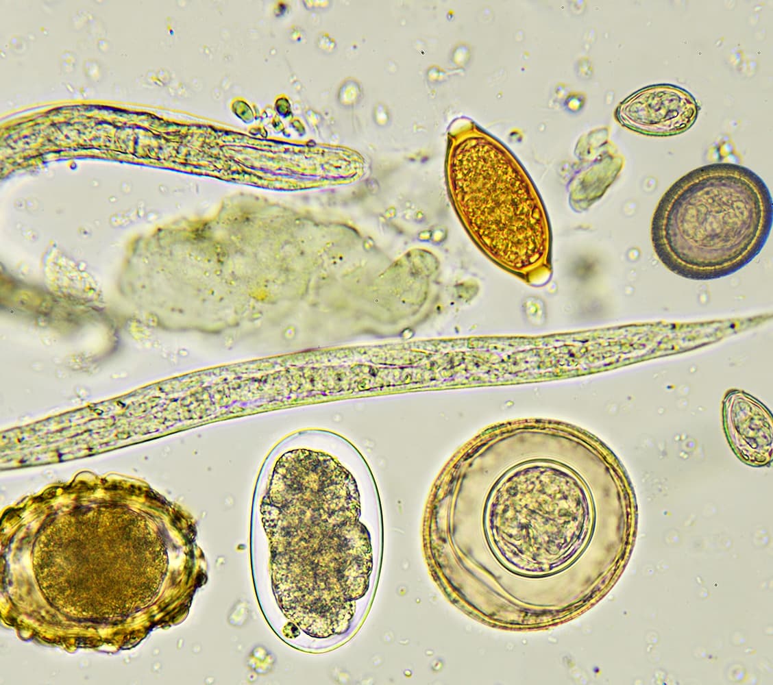 parasite detoxes: helminths under microscope