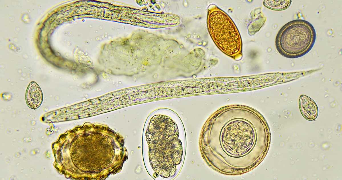 parasite detoxes: helminths under microscope